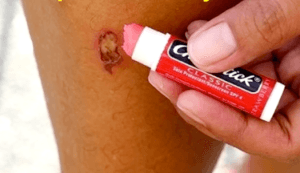 Otros usos del protector labial