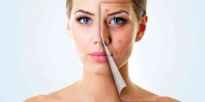 Tratamientos de belleza